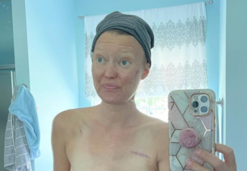 “Στα 35 μου διαγνώστηκα με καρκίνο μαστού και θέλω να θυμίζω σε όλους τι έφταιξε”: Μαμά 4 παιδιών εξομολογείται