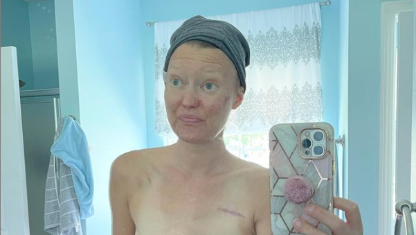 “Στα 35 μου διαγνώστηκα με καρκίνο μαστού και θέλω να θυμίζω σε όλους τι έφταιξε”: Μαμά 4 παιδιών εξομολογείται
