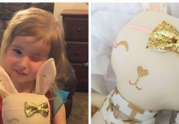 Έχασε το ματάκι της λόγω καρκίνου – Βρήκε τον εαυτό της χάρη σε μια κούκλα που της μοιάζει