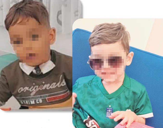 3χρονος υπεβλήθη επιτυχώς σε επέμβαση υπογλωττιδικής στένωσης τραχείας σε ελληνικό νοσοκομείο