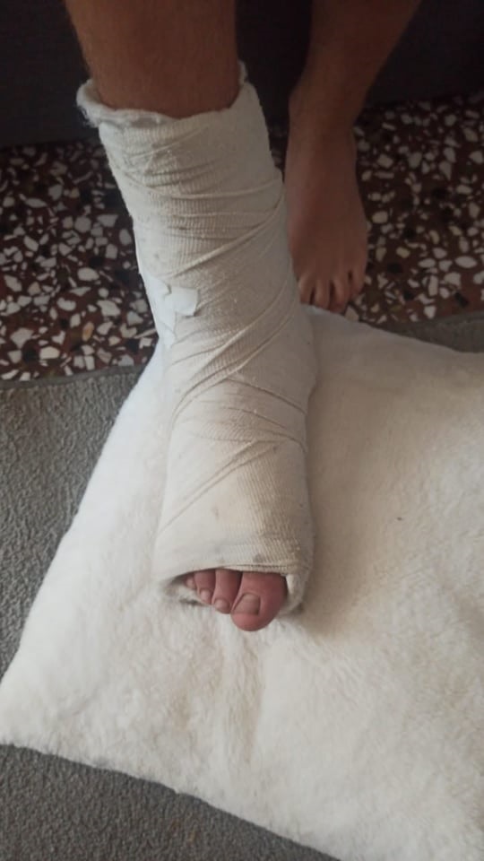 Σοκ στην Τροιζηνία: 13χρονος έπεσε θύμα άγριου bullying - Πώς βρέθηκε με σπασμένο πόδι