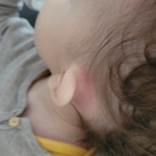 Παιδίατρος: "Προσοχή στην μαστοειδίτιδα - Η άγνωστη επιπλοκή της μέσης ωτίτιδας"