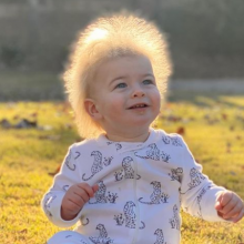 Αγοράκι 1,5 έτους έχει μαλλιά... Αϊνστάιν: Ποιο είναι το σπάνιο γενετικό σύνδρομο των μόλις 100 περιπτώσεων