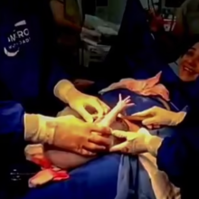 «Βγάλτε με έξω!»: Απίστευτο βίντεο δείχνει μωρό να χτυπά τον αμνιακό σάκο - Μία πολύ σπάνια γέννηση! (video)
