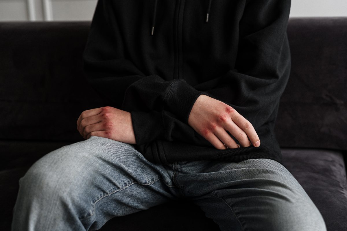 Για κακούργημα διώκονται οι ανήλικοι που επιτέθηκαν στον 14χρονο – Δίωξη και στους γονείς